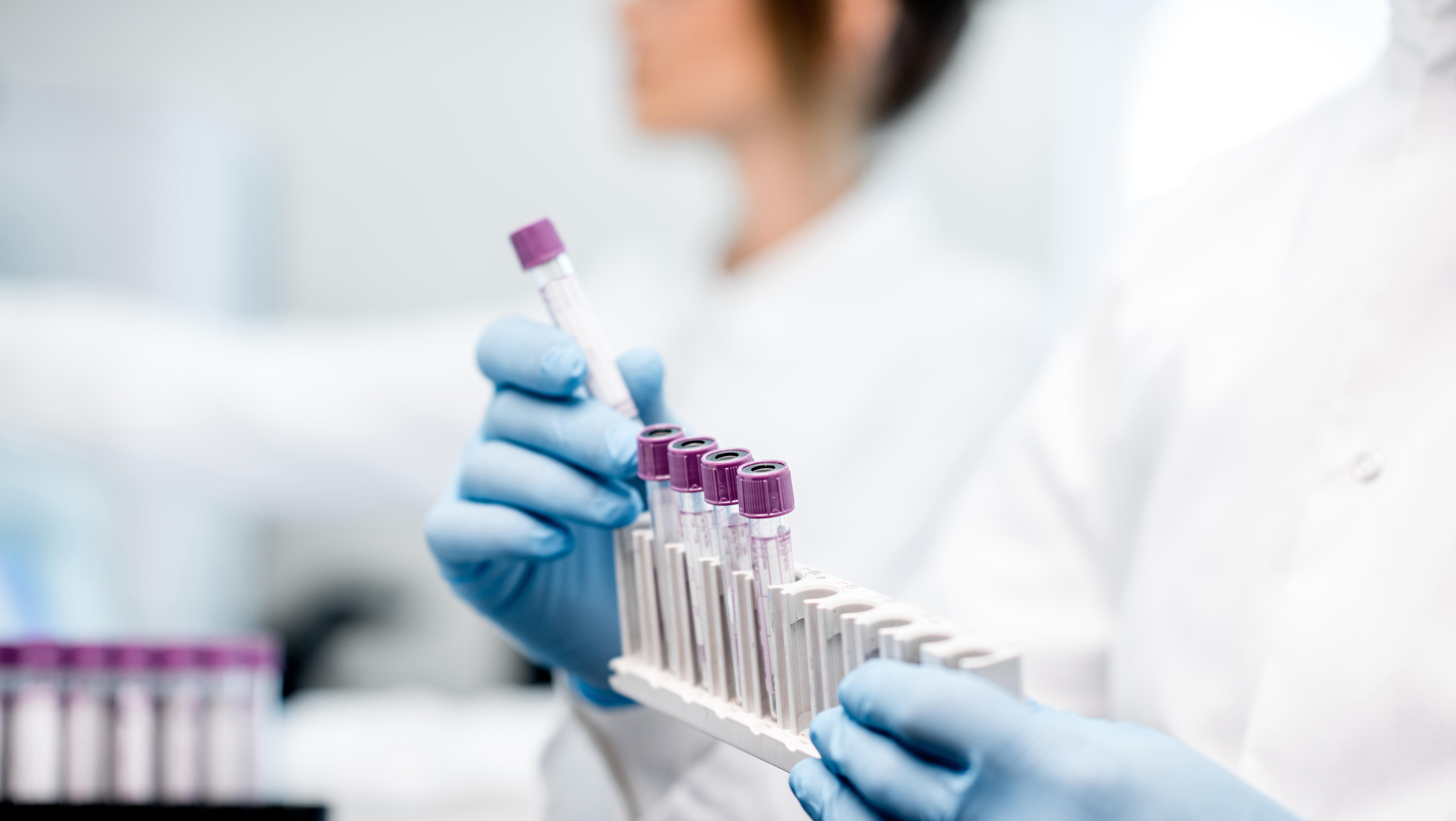 Гематология